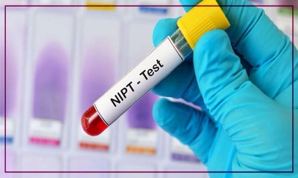 NIPS vs Amniocentesis